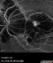 myope-rapidGA_frma_2018_17.jpg
