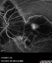 myope-rapidGA_frma_2018_18.jpg