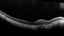 myope-rapidGA_frma_2018_20.jpg