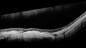 myope-rapidGA_frma_2018_22.jpg