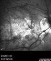 myope-rapidGA_frma_2018_23.jpg