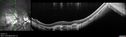 myope-rapidGA_frma_2018_24.jpg
