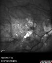 myope-rapidGA_frma_2018_26.jpg