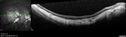 myope-rapidGA_frma_2018_28.jpg