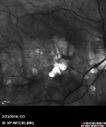 myope-rapidGA_frma_2018_29.jpg