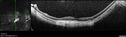myope-rapidGA_frma_2018_30.jpg
