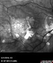myope-rapidGA_frma_2018_32.jpg