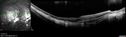myope-rapidGA_frma_2018_34.jpg