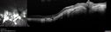 myope-rapidGA_frma_2018_40.jpg