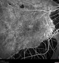 myopic-cnvm_suboy_032720_16.jpg