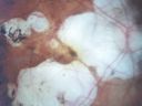 myopicamdodwet_jeli01.jpg