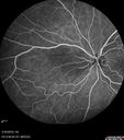 nasal-brao_inmur_031618_12.jpg