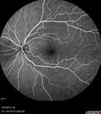 nasal-brao_inmur_031618_13.jpg