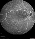 nasal-brao_inmur_031618_14.jpg