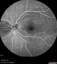 nasal-brao_inmur_031618_15.jpg