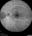 nasal-brao_inmur_031618_17.jpg