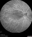 nasal-brao_inmur_031618_18.jpg