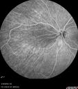 nasal-brao_inmur_031618_19.jpg