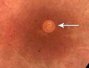 nematode05.jpg
