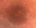 nematode18.jpg
