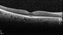 nerve-pit_112919_121721_05.jpg