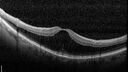 nerve-pit_112919_121721_07.jpg