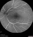 nerve-pit_112919_121721_16.jpg