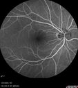 nerve-pit_112919_121721_17.jpg