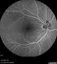 nerve-pit_112919_121721_18.jpg