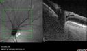 nerve-pit_112919_121721_19.jpg