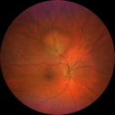 nevus_edgro_2016-2019_01.png