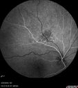 nevus_edgro_2016-2019_16.jpg