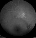 nevus_edgro_2016-2019_23.jpg
