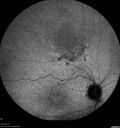 nevus_edgro_2016-2019_34.jpg