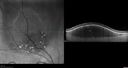 nevus_edgro_2016_08.jpg