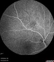 nevus_edgro_2016_42.jpg