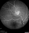 nevus_edgro_2016_48.jpg