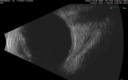 nevus_macas_11171906.png