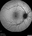 nevus_stbuc_090922_04.jpg