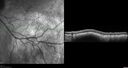 nevus_stbuc_090922_07.jpg