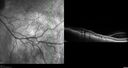nevus_stbuc_090922_08.jpg