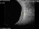 nevus_stbuc_090922_09.jpg