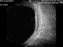 nevus_stbuc_090922_10.jpg