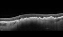 nevus_supa_022118_07.jpg