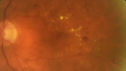 npdr_thwr_062818_04.jpg