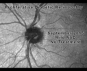 nvd2.gif