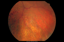 nvd_1mopostlaser_newlaser_mapa03.png