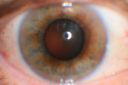 odnoninflammedbrown.jpg