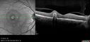 ohs3_cnvm_maja_021315_39.jpg