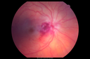 orbcell_pabr_101915_02.png